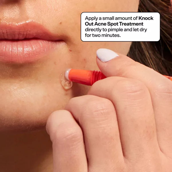 PREVENTA Tratamiento para acné Bubble