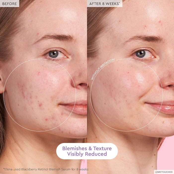 PREVENTA Glass Skin Hydration Kit Glow Recipe