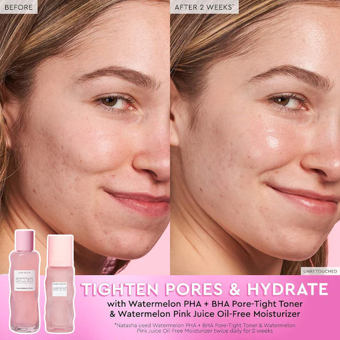 PREVENTA Set Rutina Completa Glow Recipe