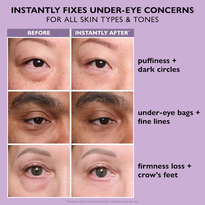 PREVENTA Instant FIRMx® Eye -Peter Thomas Roth