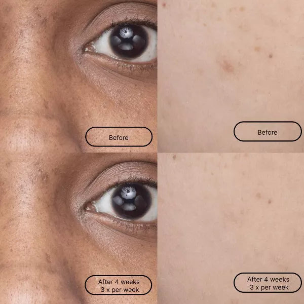 PREVENTA Mascarilla LOOPS - Hyper Smooth Dark Spot